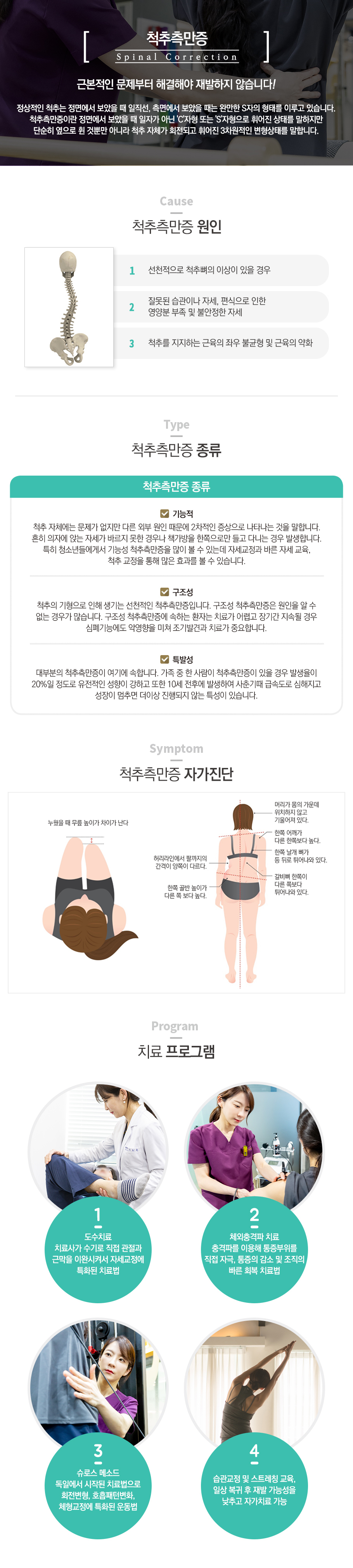 척추측만증