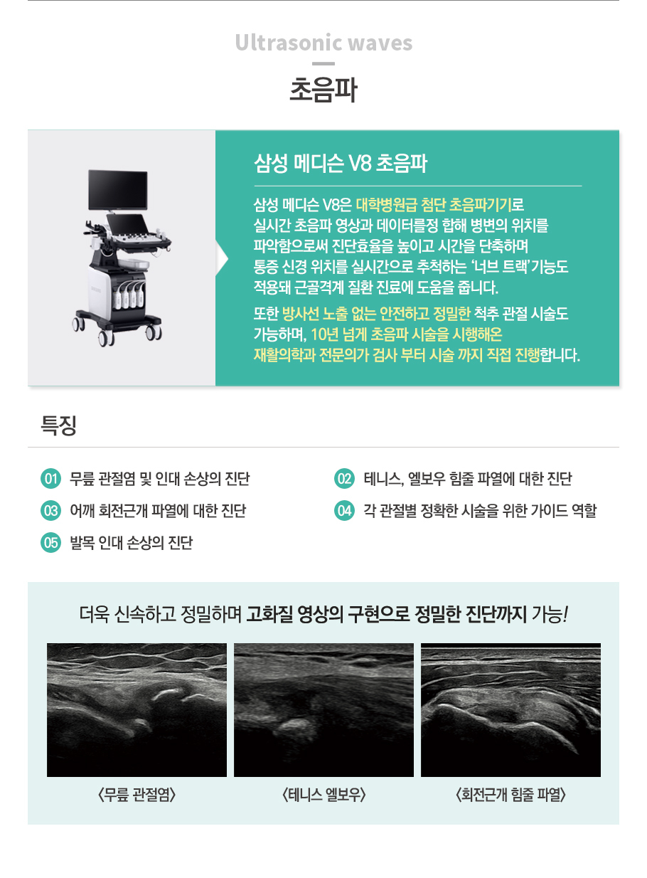 삼성 메디슨 초음파
