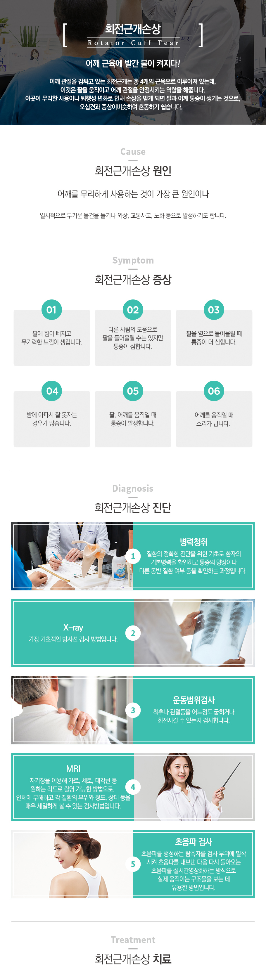 회전근개질환