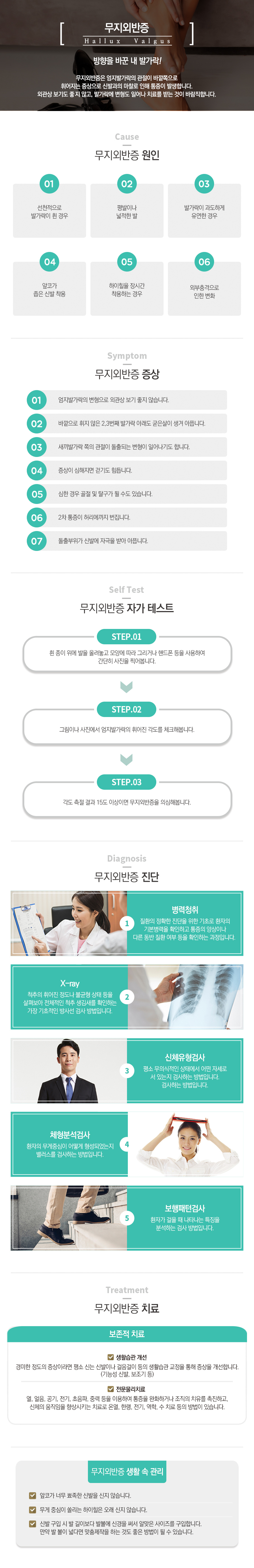 무지외반증
