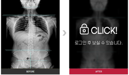 목, 허리통증 전후 사진