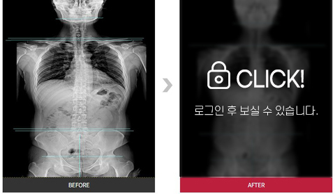 목, 허리통증 전후 사진