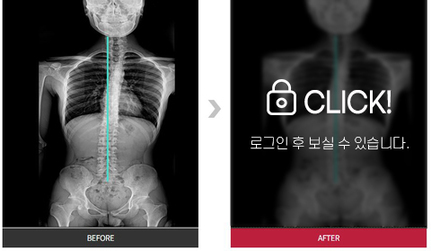 턱관절 및 목통증 전후 사진