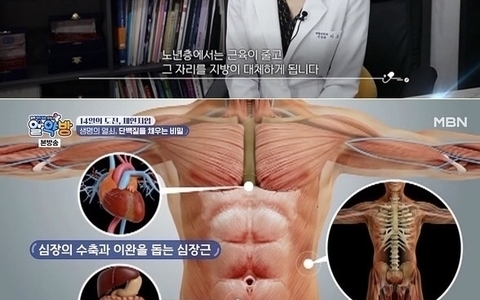 mbn 알약방 근육감소증 편